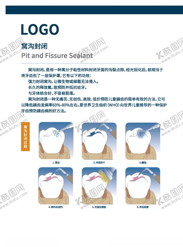 编号：44330304210210514204【酷图网】源文件下载-口腔知识窝沟封闭步骤展板海报