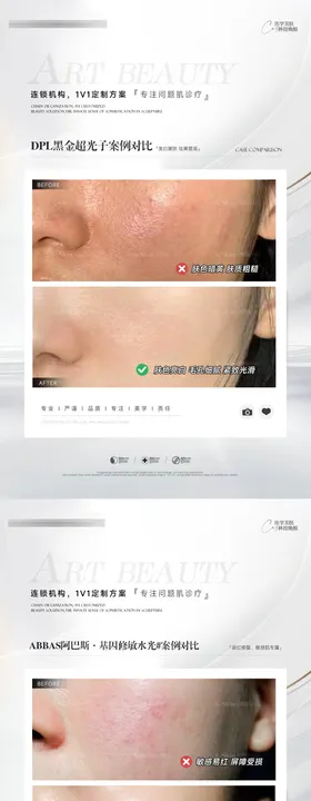 医美案例对比系列海报