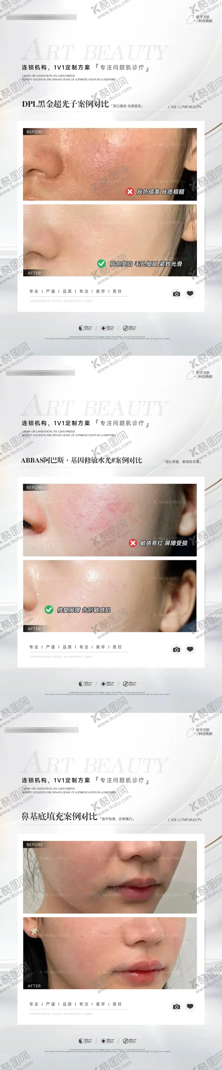编号：30297605131455007525【酷图网】源文件下载-医美案例对比系列海报