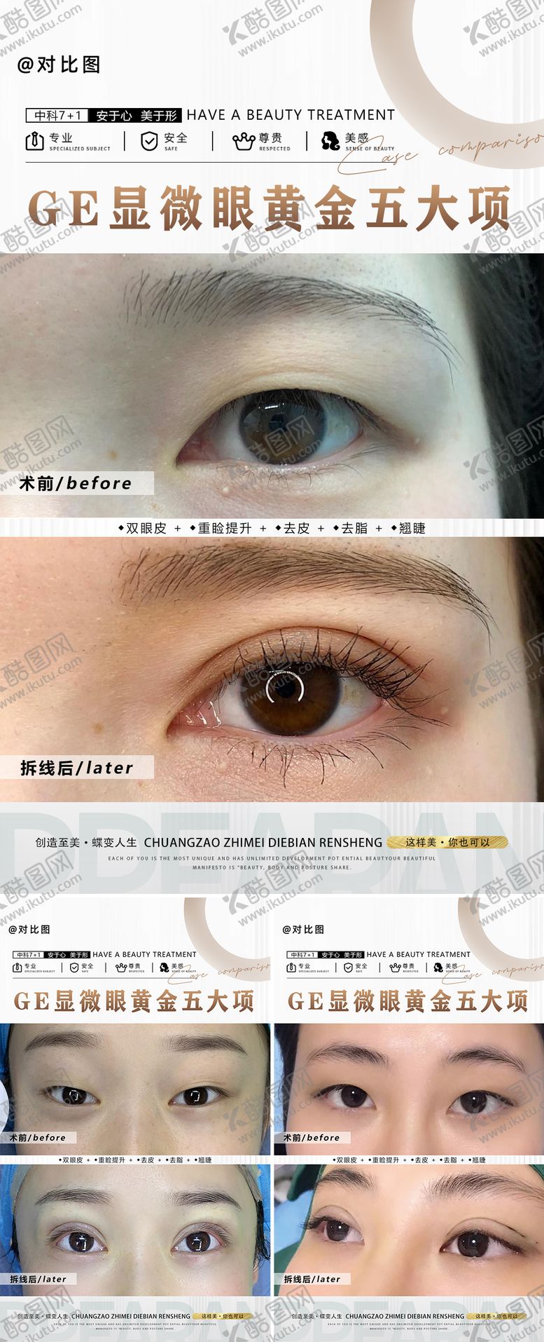 编号：77682711240656498090【酷图网】源文件下载-医美双眼皮对比案列
