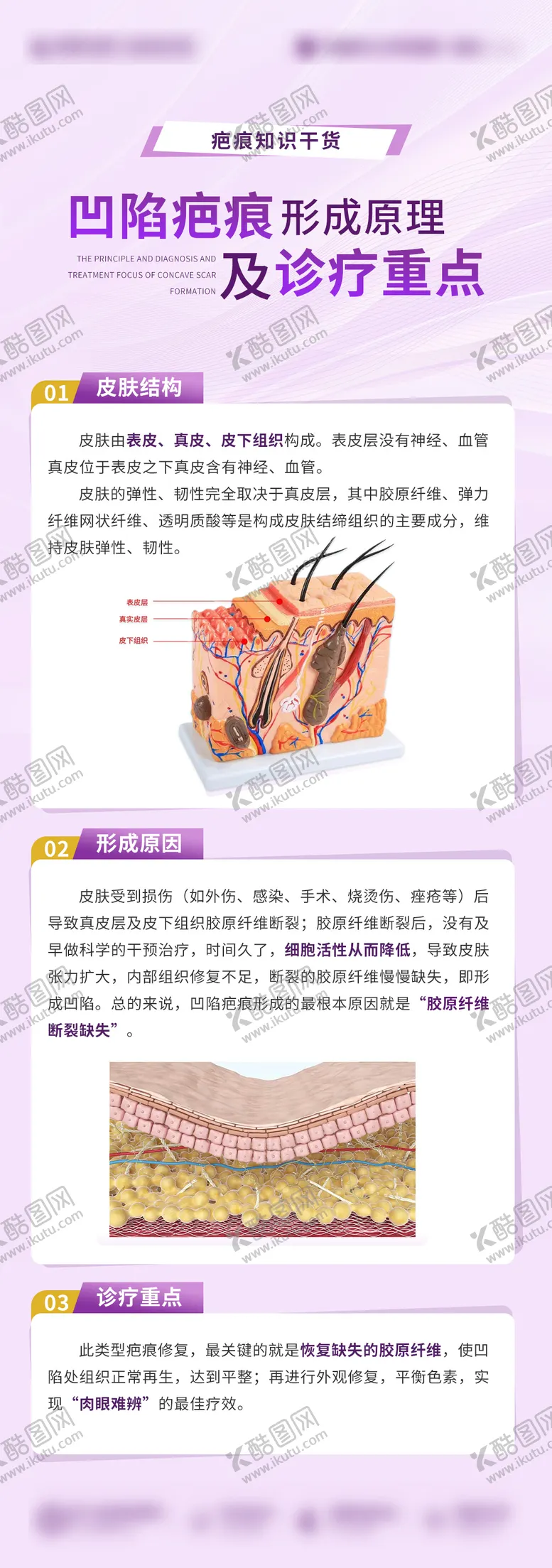 编号：96675511302248288444【酷图网】源文件下载-疤痕科普 