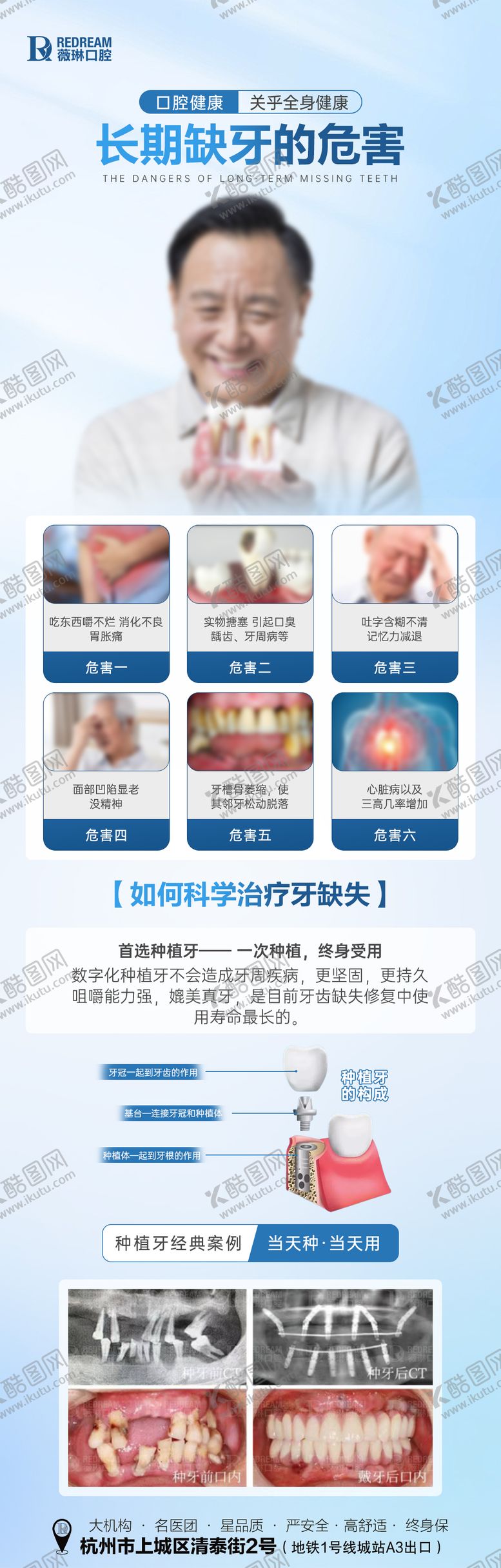 编号：87153609080652305164【酷图网】源文件下载-口腔种植牙长图海报