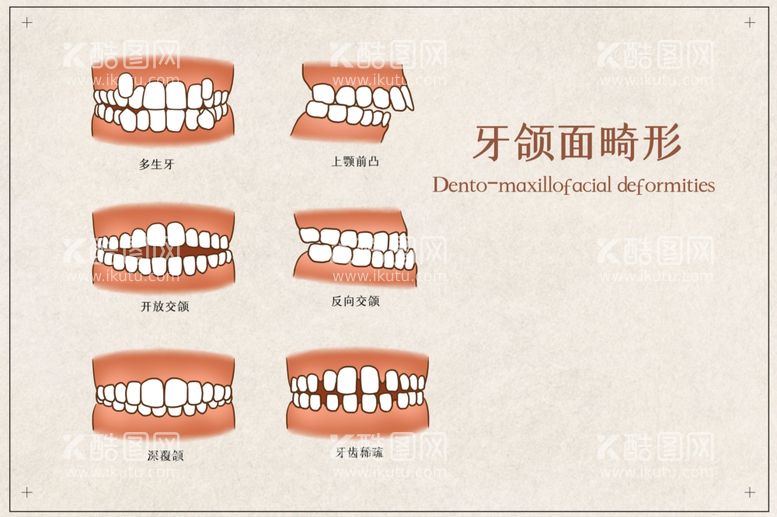 编号：67112911251619551573【酷图网】源文件下载-牙颌面畸形